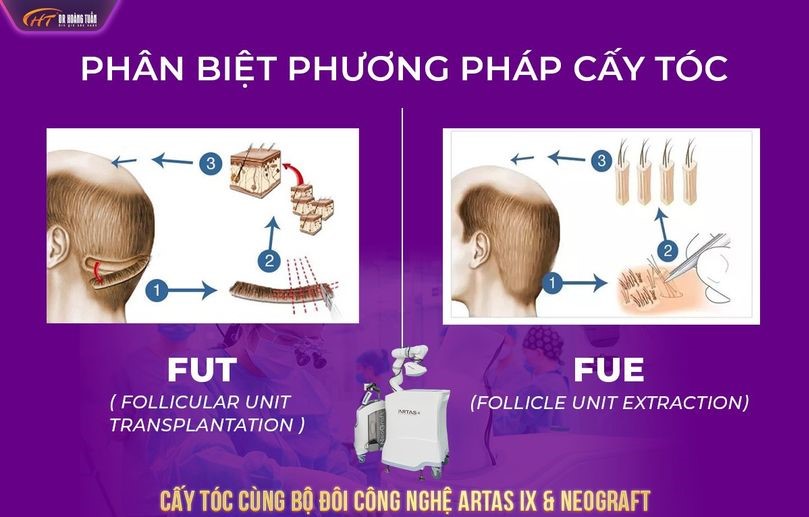  yếu tố ảnh hưởng đến cấy t&oacute;c