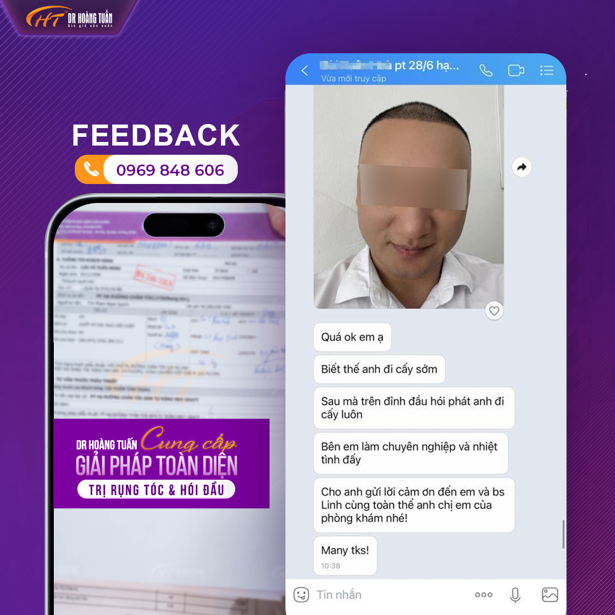 chi ph&iacute; cấy t&oacute;c