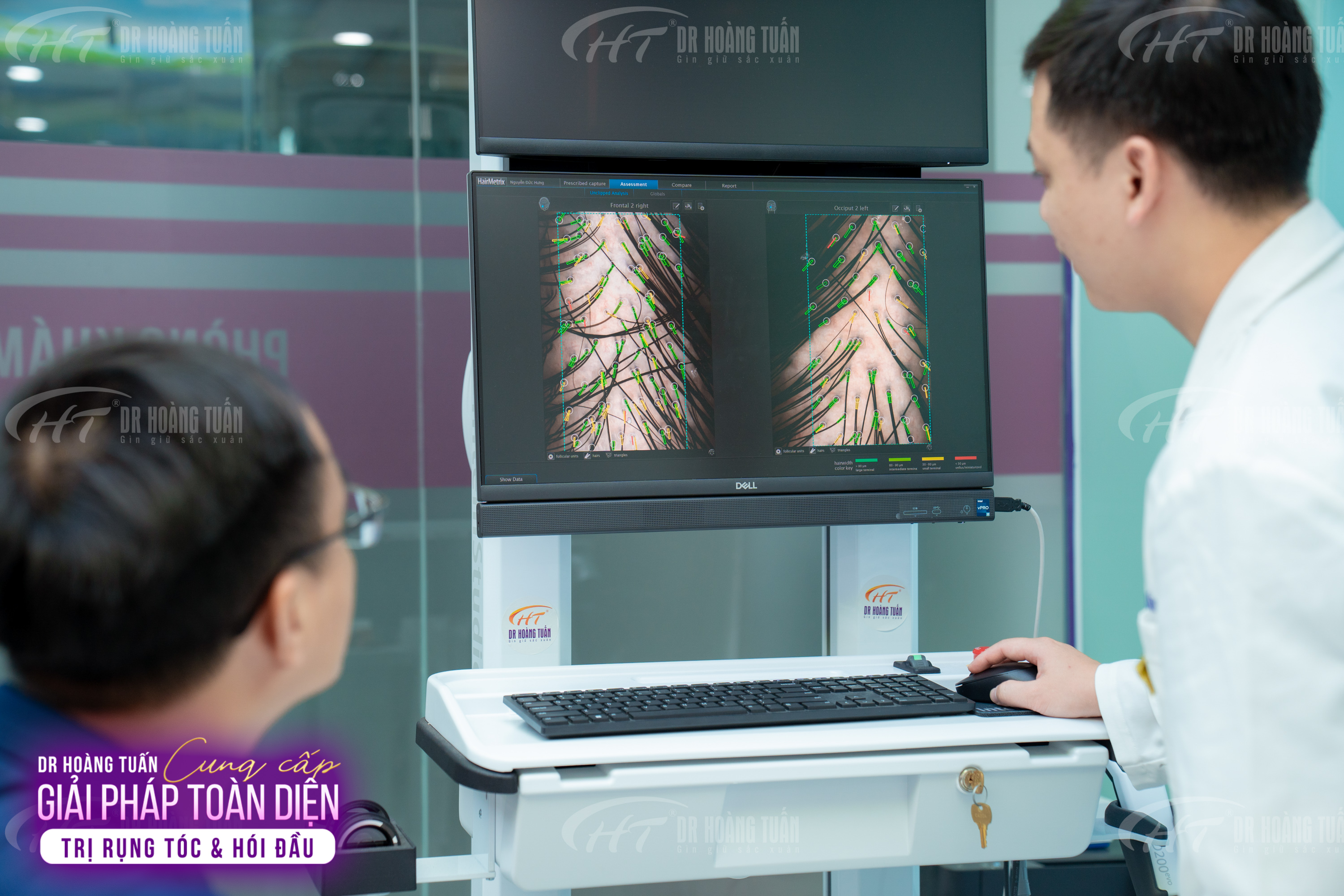 chi ph&iacute; cấy t&oacute;c