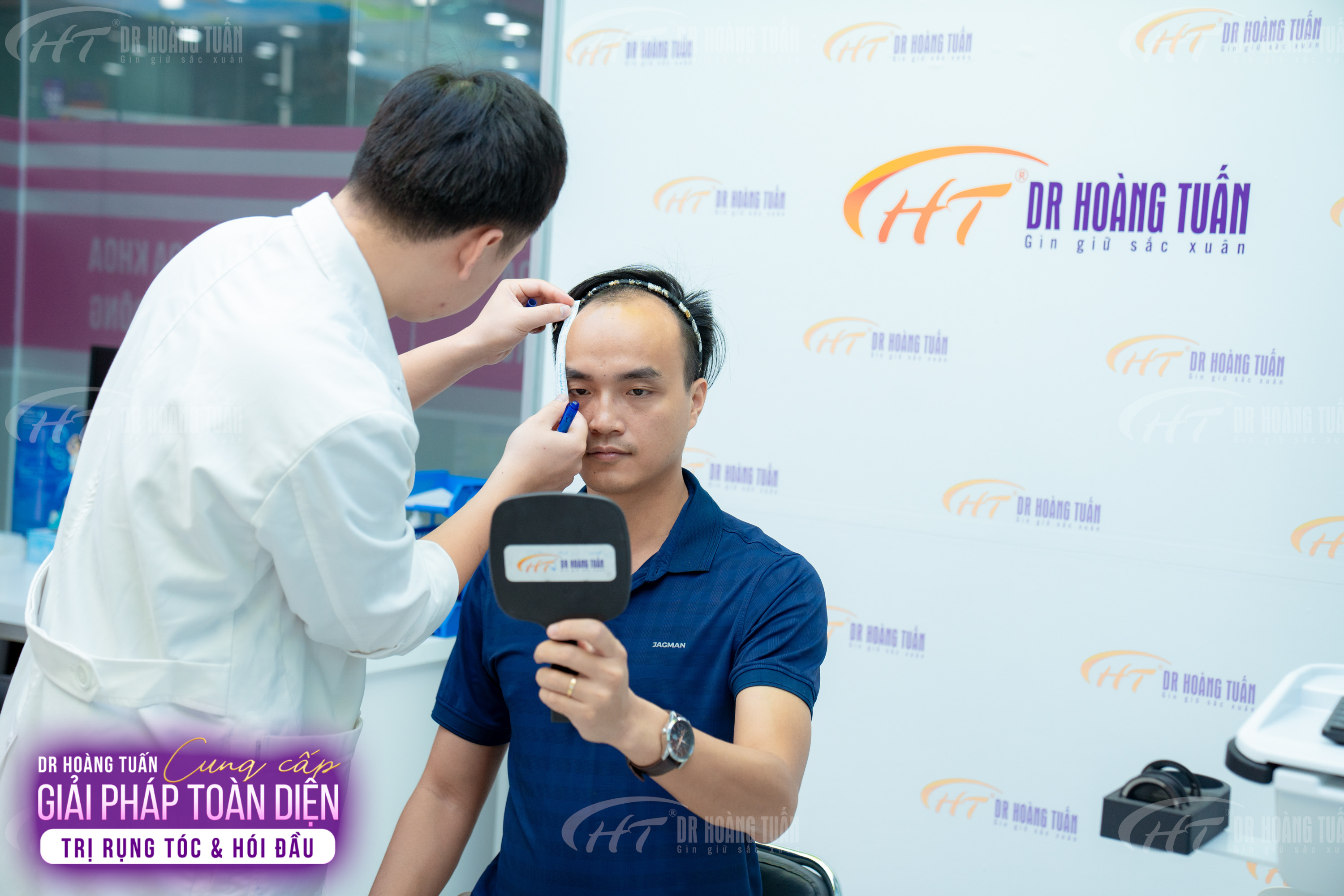 chi ph&iacute; cấy t&oacute;c 