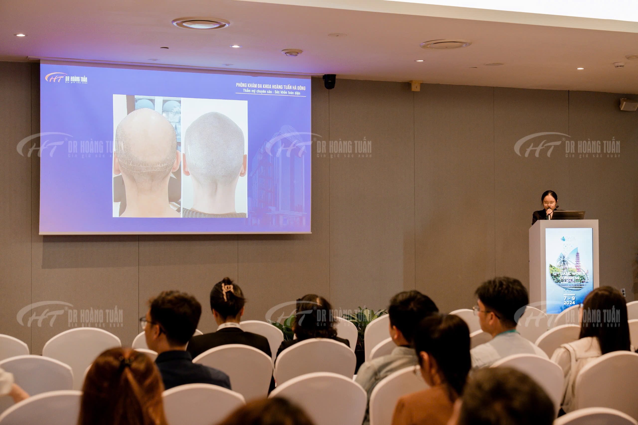 Ths. Bs Nguyễn Diệu Linh tham gia b&aacute;o c&aacute;o tại Hội nghị Quốc tế Thẩm mỹ Quốc tế lớn nhất to&agrave;n cầu DASIL 2024 - Robot cấy t&oacute;c tự động ARTAS&reg; iX.