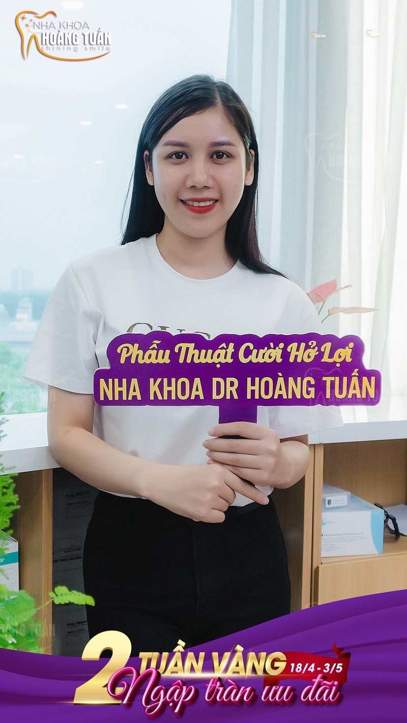 Điều trị cười hở lợi