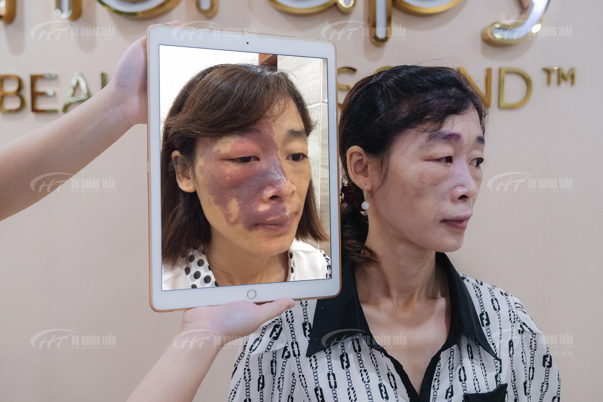 Hành trình lột xác của mẹ đơn thân sống chung với u máu bẩm sinh