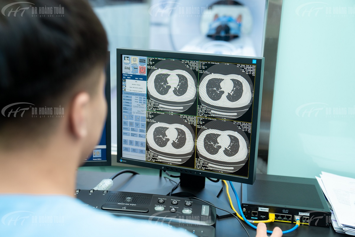 CÁCH DUY NHẤT GIÚP PHÁT HIỆN UNG THƯ PHỔI TỪ GIAI ĐOẠN SỚM