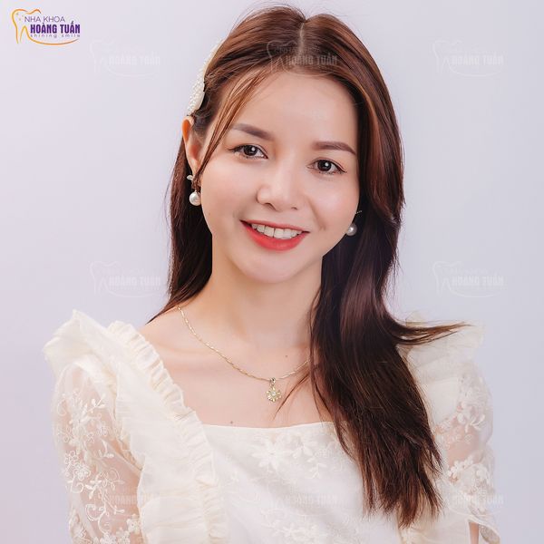 Hành trình niềng răng bị hô, răng khấp khểnh của cô giáo trẻ 9X