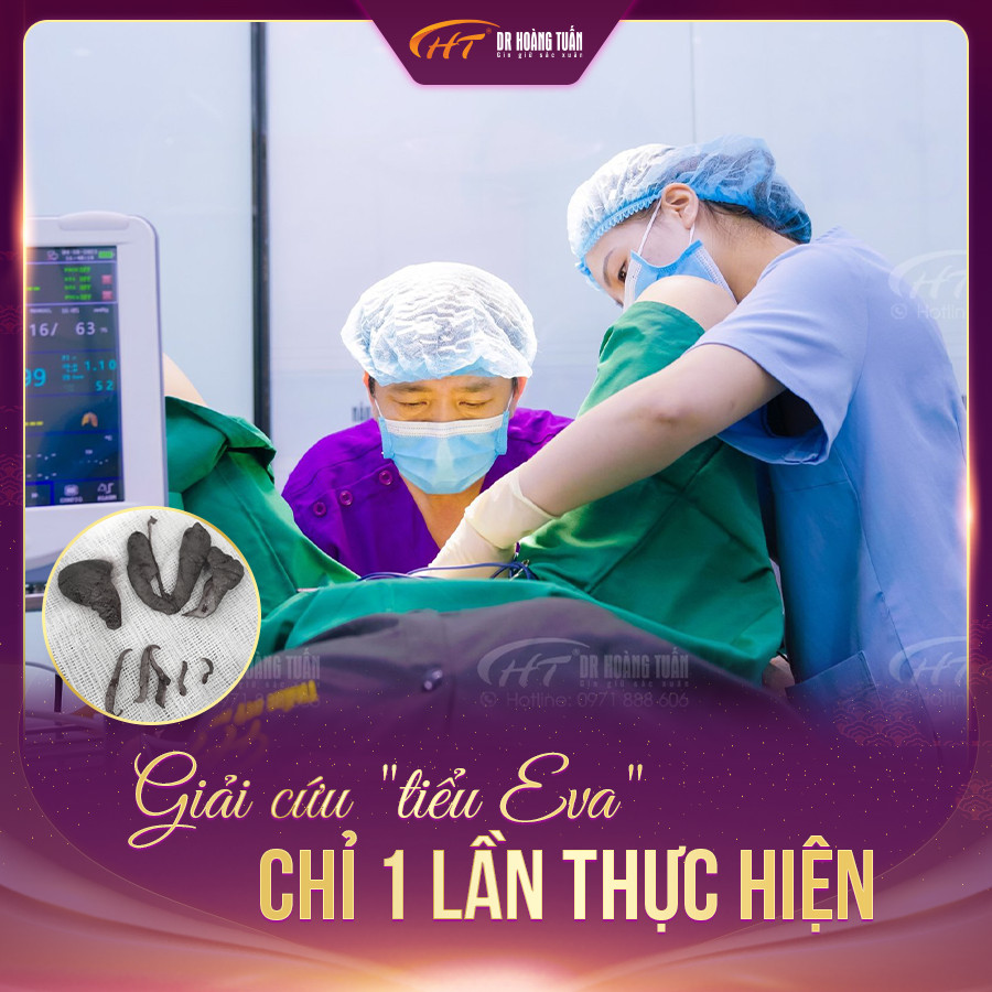 b&aacute;c sĩ thẩm mỹ v&ugrave;ng k&iacute;n