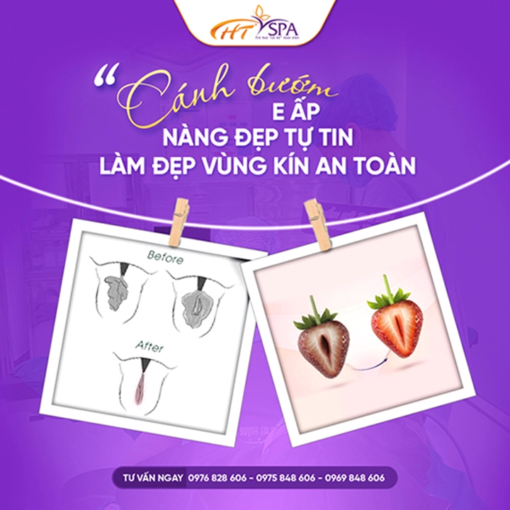 H&igrave;nh minh họa l&agrave;m hồng v&ugrave;ng k&iacute;n bằng thẩm mỹ qua biểu tượng tr&aacute;i c&acirc;y, V&ugrave;ng k&iacute;n xuống cấp