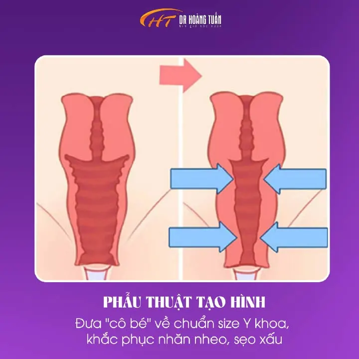 So s&aacute;nh trước v&agrave; sau khi thu gọn tần, V&ugrave;ng k&iacute;n xuống cấp